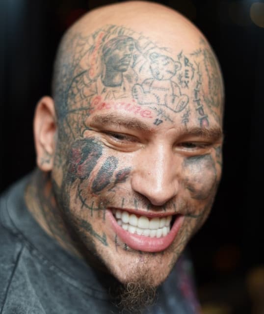 Stitches