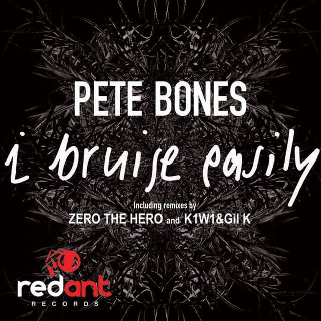 I Bruise Easily - Zero the Hero Remix cover art
