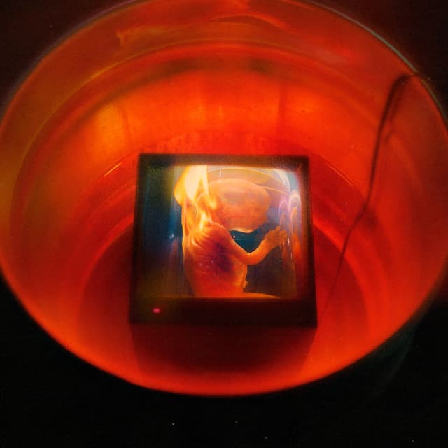 Wild and Lethal Trash! (feat. Fire! & Santigold) cover art