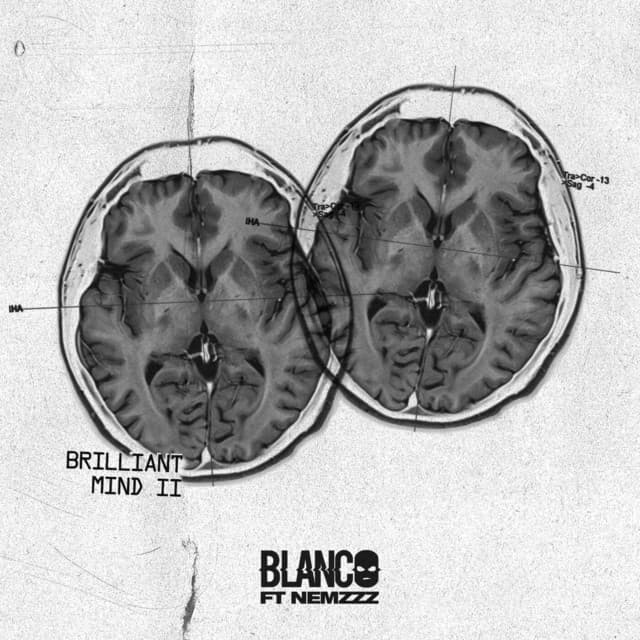Brilliant Mind II cover art